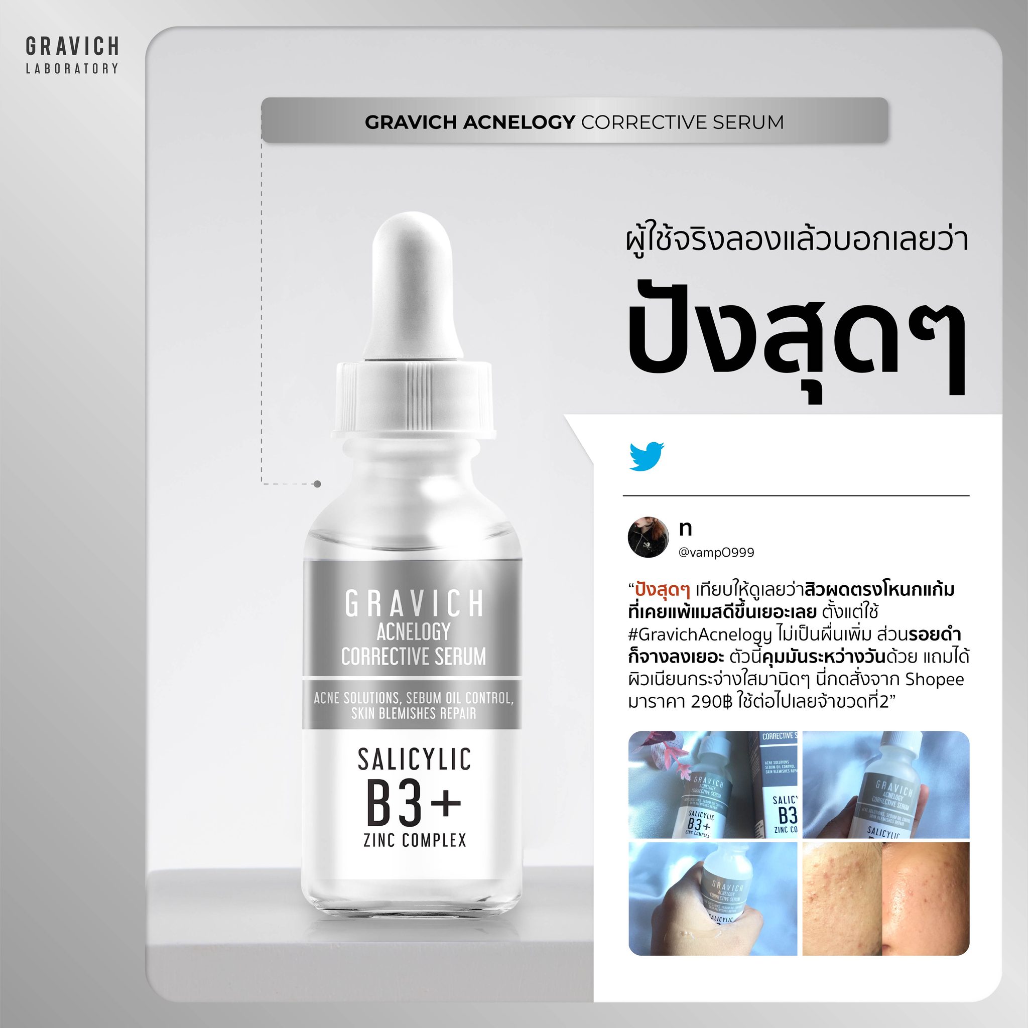 รีวิวเซรั่ม Gravich Acnelogy Corrective Serum